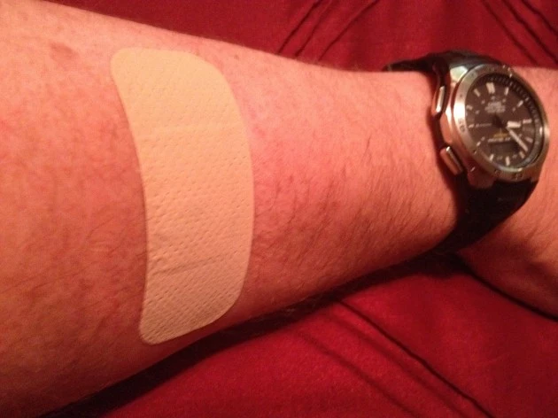 Todd Harding's arm Man's arm with Bandaid